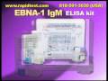 EBNA 1 IgM ELISA kit