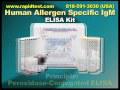 Human Specific IgM ELISA kit