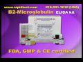 Beta2 Microglobulin ELISA kit