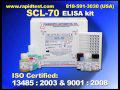 SCL-70 ELISA kit