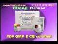 HBeAg ELISA kit