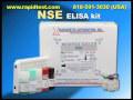 NSE ELISA kit