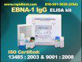 EBNA 1 IgG ELISA kit