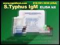 S.Typhus IgM ELISA kit